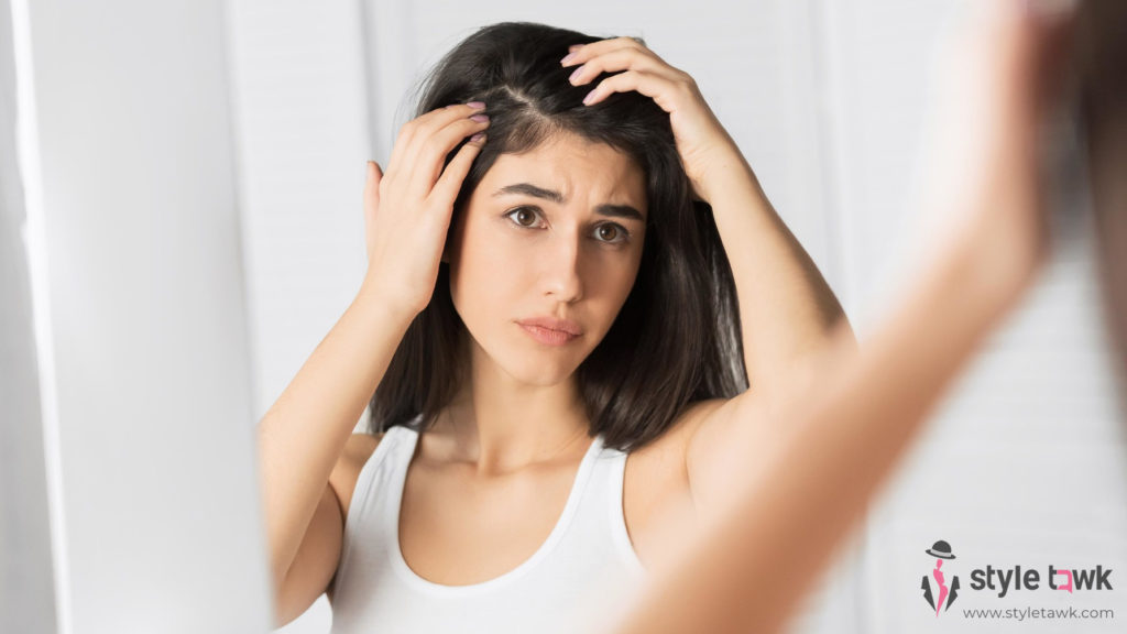 Home Remedies for Dandruff